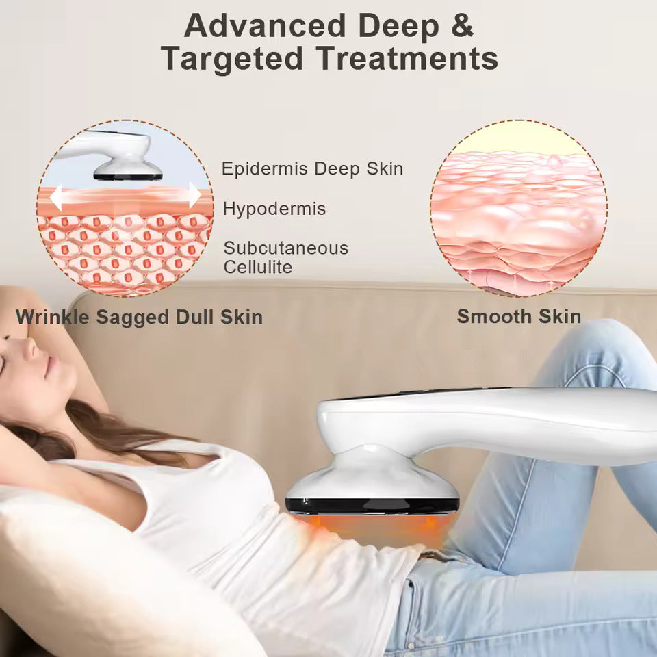Cellulite Massager — Body Sculpting & Skin Toning Device